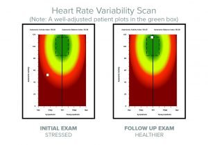 stress, brain fog, hrv, chiropractic, powerhouse chiropractic, Vancouver