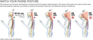 anterior spinal distortion, forward head posture, powerhouse chiropractic, vancouver chiropractor, vancouver, chiropractic