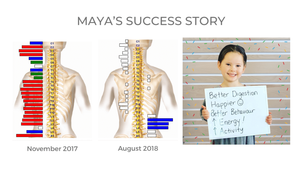 Chiro4kids, kids chiropractor, vancouver chiropractor, chiropractic, vancouver, powerhouse, powerhouse chiropractic, teens, teenager, teen, kids