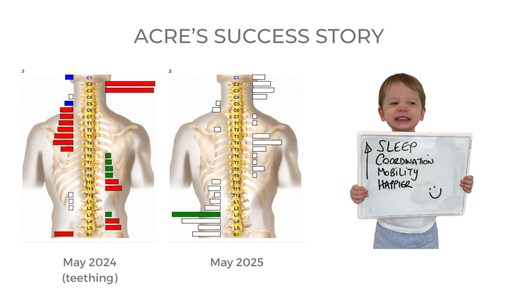 Chiro4kids, kids chiropractor, vancouver chiropractor, chiropractic, vancouver, powerhouse, powerhouse chiropractic, teens, teenager, teen, kids